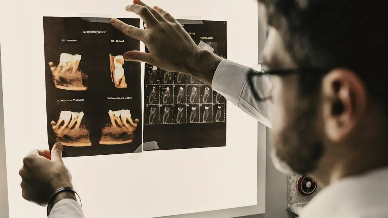 Arts die een röntgenfoto bekijkt